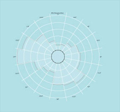wind-rose