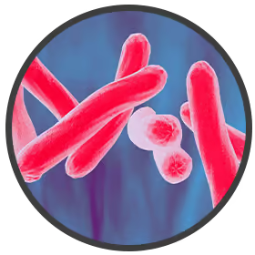tubercolosis